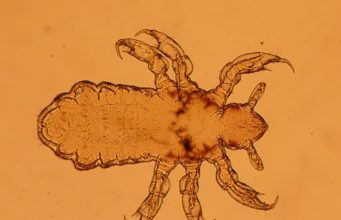 How To Get Rid Of Head Lice On Your Dog